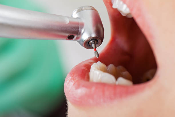 Best Emergency Gum Treatment in Chadron, NE